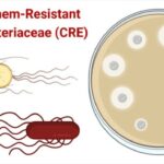 Carbapenem-Resistant Enterobacteriaceae (CRE)